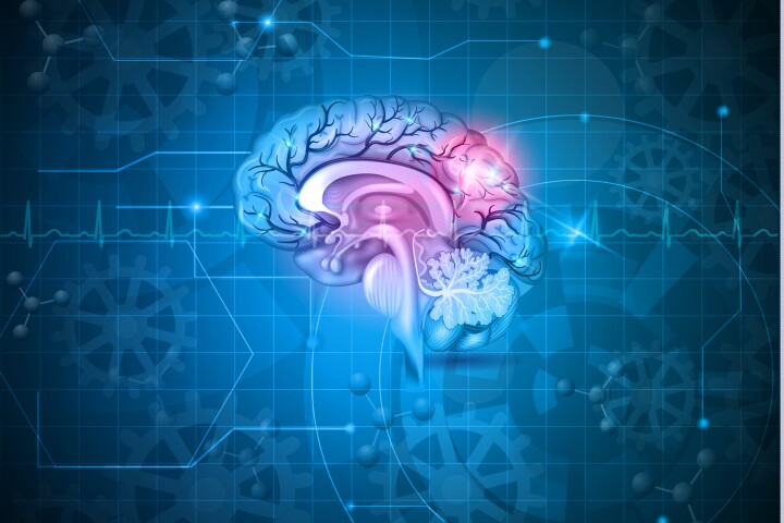 New research has homed in on how shingles triggers a pathological process that can increase a person's risk of experiencing stroke