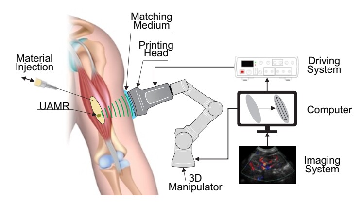 A diagram illustrates how DSP could be used to print a structure within a patient's arm