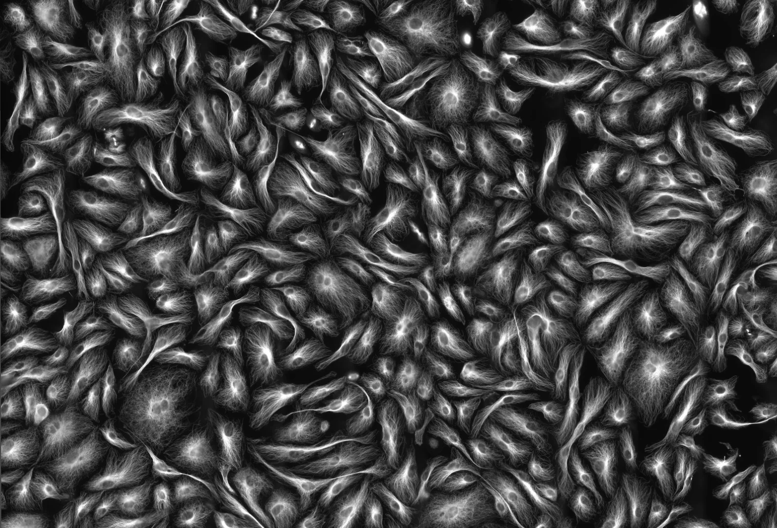 Image of Distinction: Microtubules in human umbilical vein endothelial cells (HUVEC)