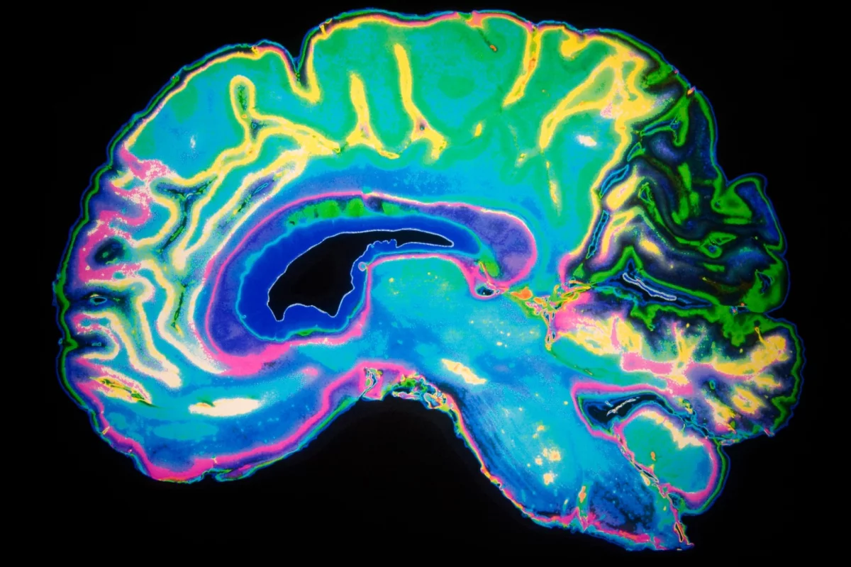 Salk Institute scientists have identified how a promising Alzheimer's drug works on the molecular level