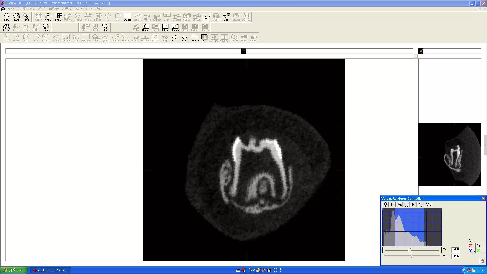 Scan of a natural tooth