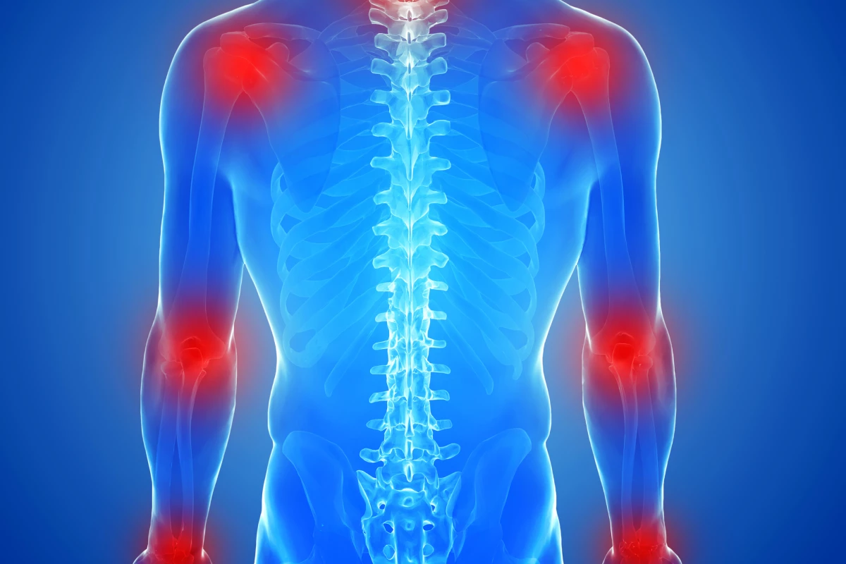 A new study has pinpointed a biological mechanism behind spreading inflammation in rheumatoid arthritis