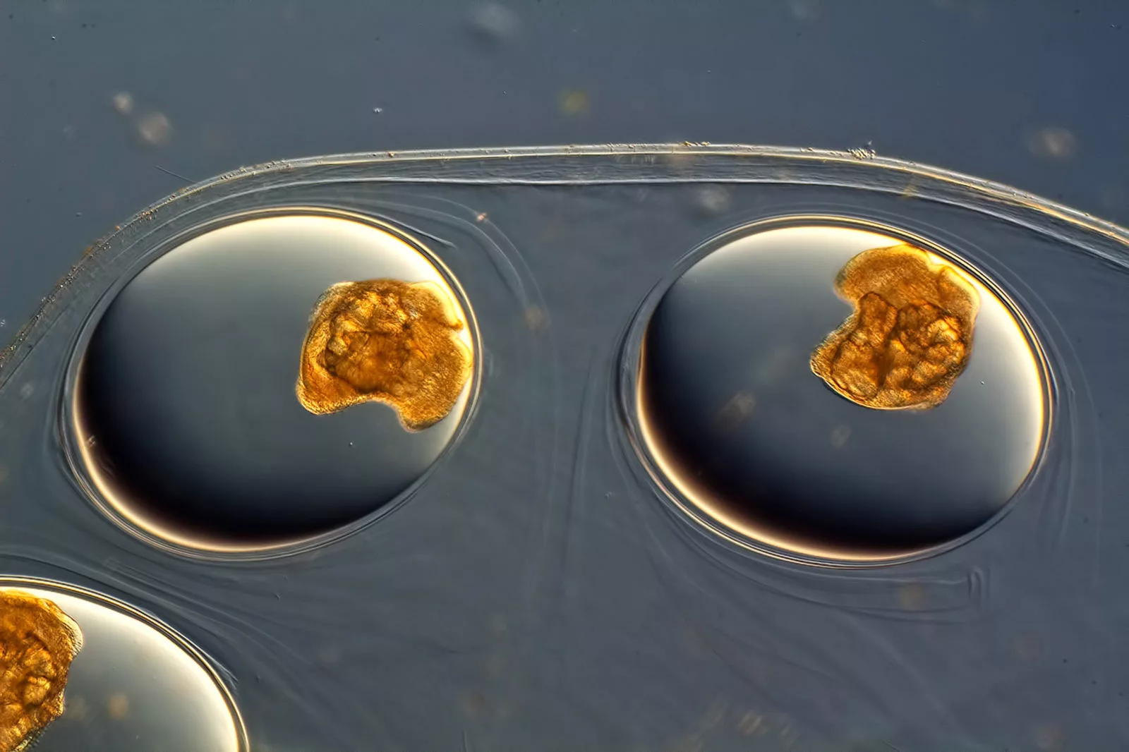 Image of Distinction: Freshwater snail eggs