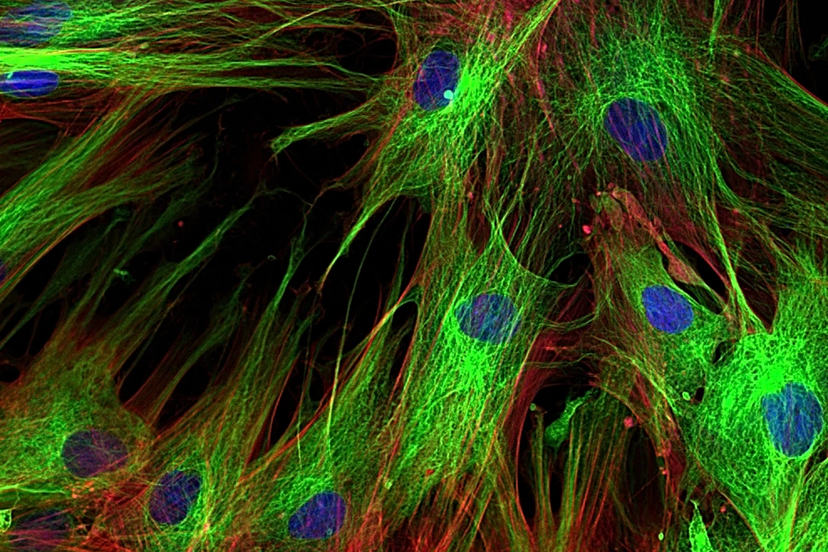 The key to the new research involved getting fibroblasts like these to convert into healthy heart tissue, thus helping restore its elasticity