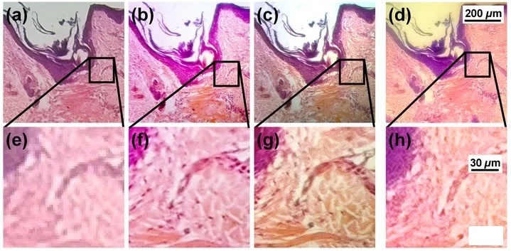Images a) to c) show human skin and hair follicle captured through a microscope at magnifications of 40, 100 and 200, while d) is an image captured with a smartphone using a PDMS lens and Nokia Lumia 520 – the lowermost row shows the regions magnified (Image: University of Houston)
