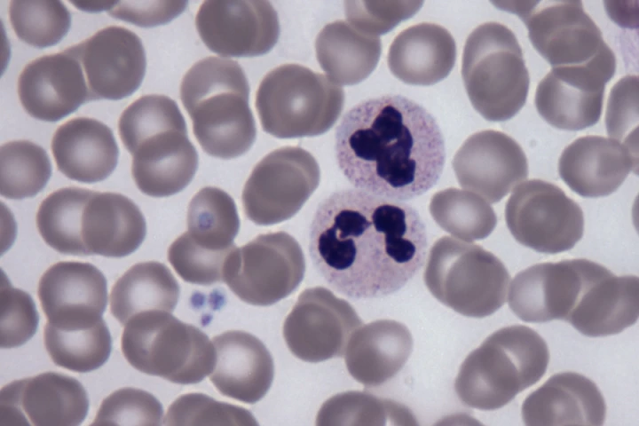 A new study has found that a protein called YTHDF2 plays a role in protecting blood stem cells from damage