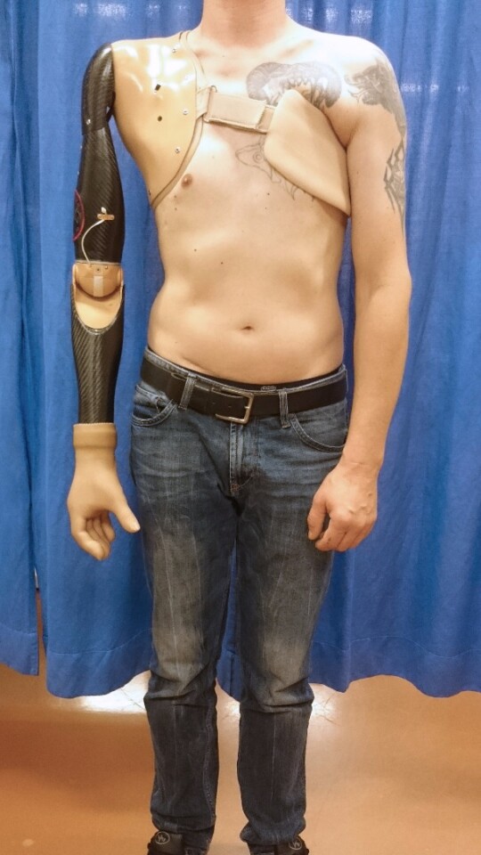 Instead of relying on twitches from damaged muscles, this robotic arm is controlled by the user's thoughts