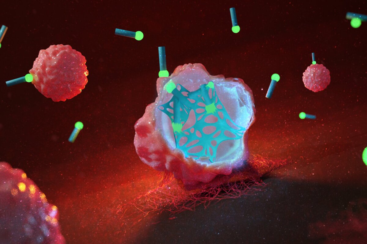 An artist's render of cancer cells with a "web" growing inside them