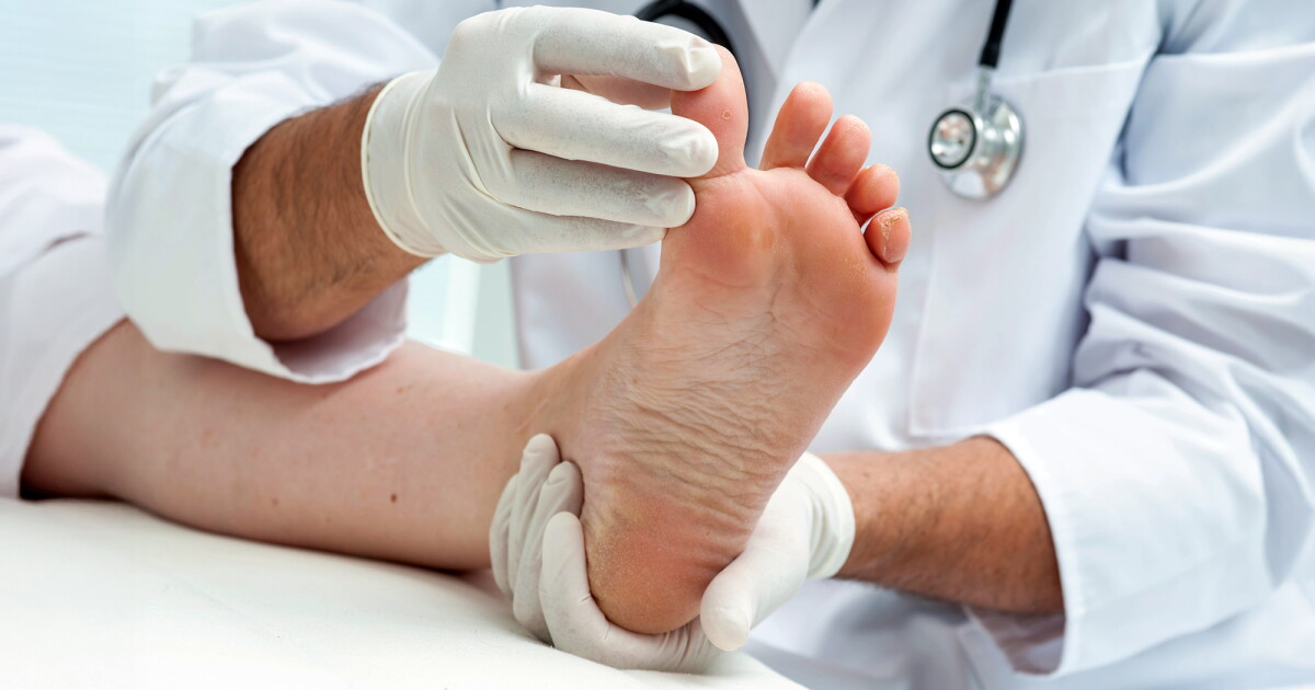 TEWL: The right tool for predicting the return of diabetic foot ulcers