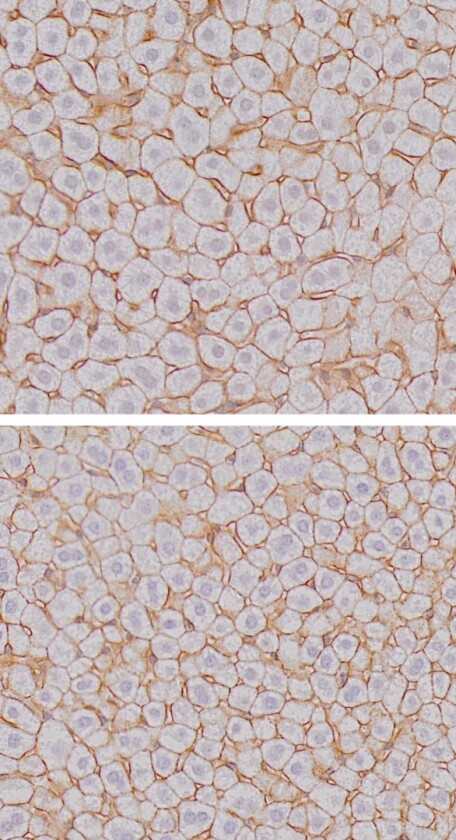 Liver cells at the end of the night (top), after the mice had been feeding compared to liver cells during the day (bottom)
