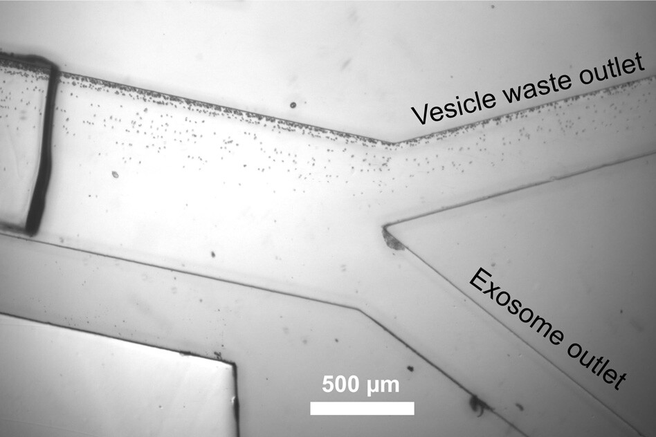 Exosomes are separated from other vesicles as they flow through a microfluidic channel, guided by sound waves