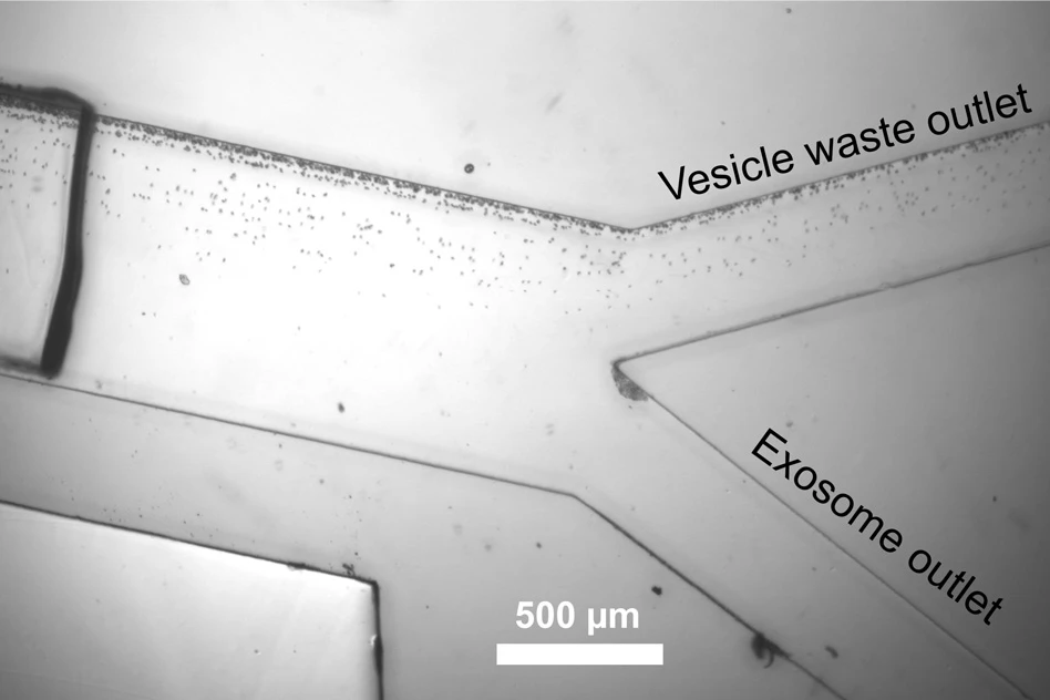 Exosomes are separated from other vesicles as they flow through a microfluidic channel, guided by sound waves