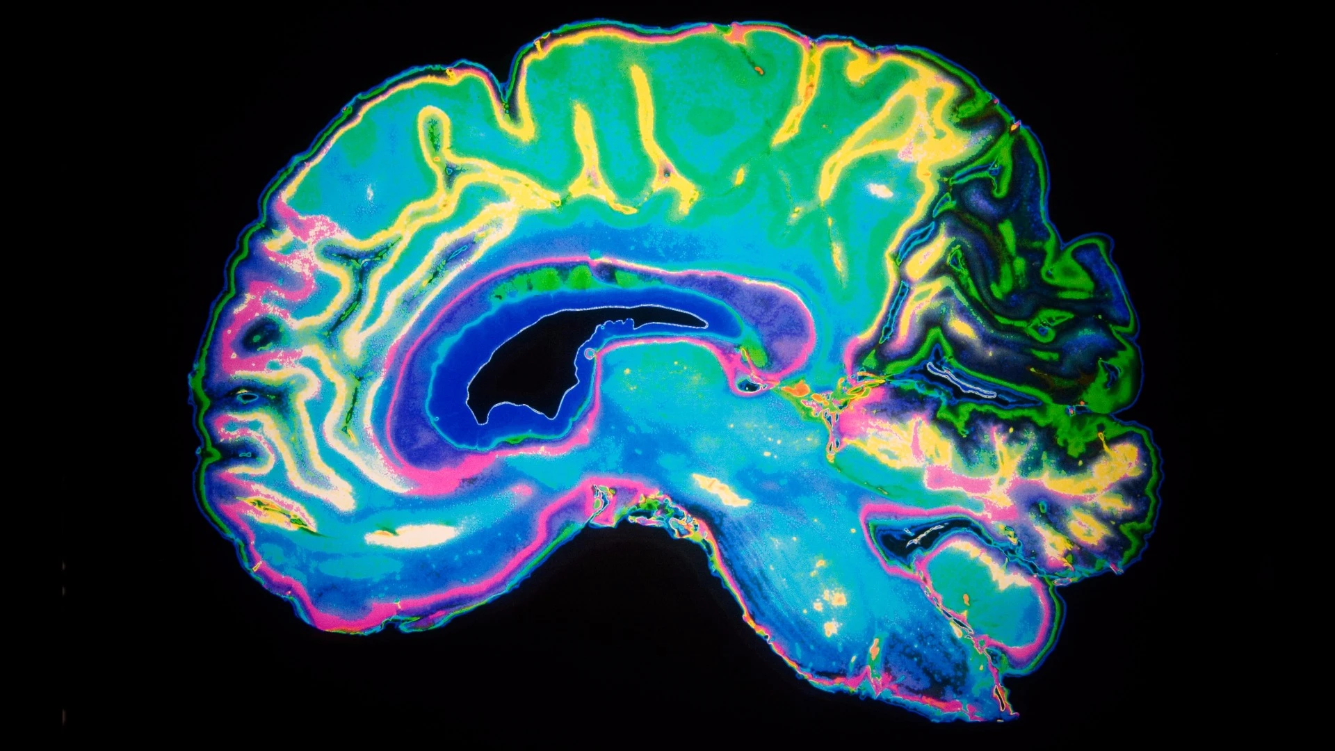 A new Harvard study offers another clue into the neurological foundation of psychopathic behavior