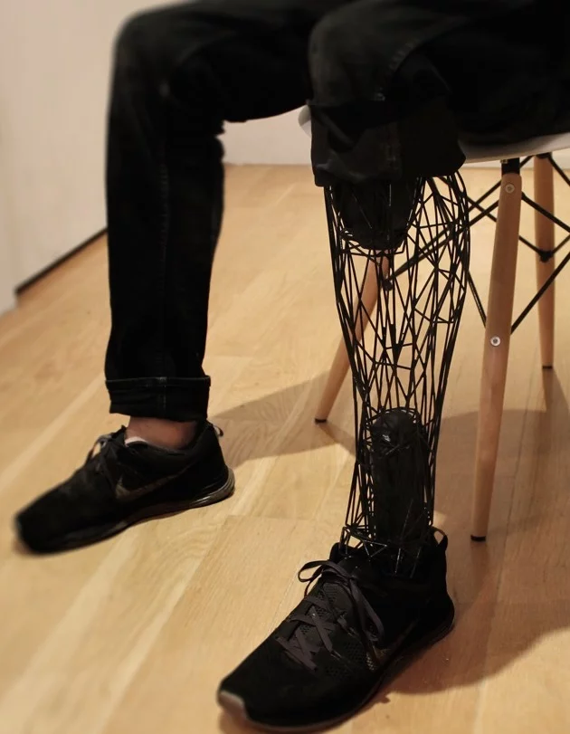 The Exo-Prosthetic is 3D printed out of titanium which is extremely durable and lightweight (Photo: Will Root)