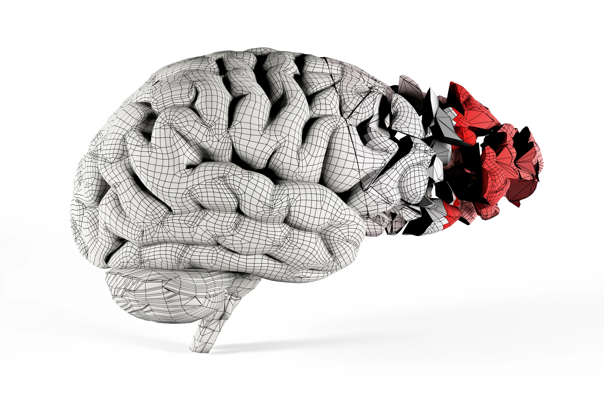 Researchers claim to have identified the first direct mechanism linking inflammation with the neurodegeneration seen in Alzheimer's disease