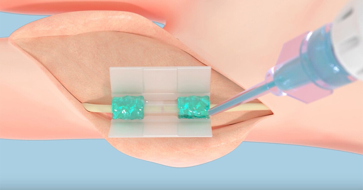 New biopolymer tech revolutionizes tissue repair New biopolymer tech revolutionizes tissue repair