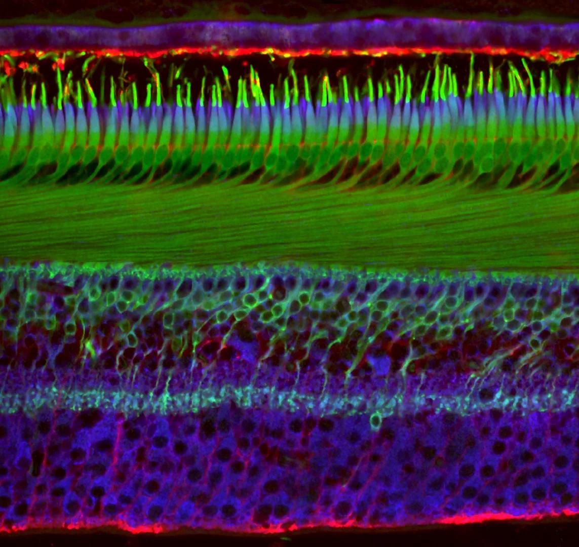 20th Place, Human retina