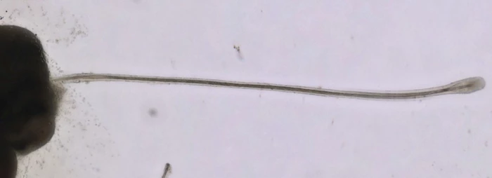 Scientists have managed to grow fully functional hair follicles in culture