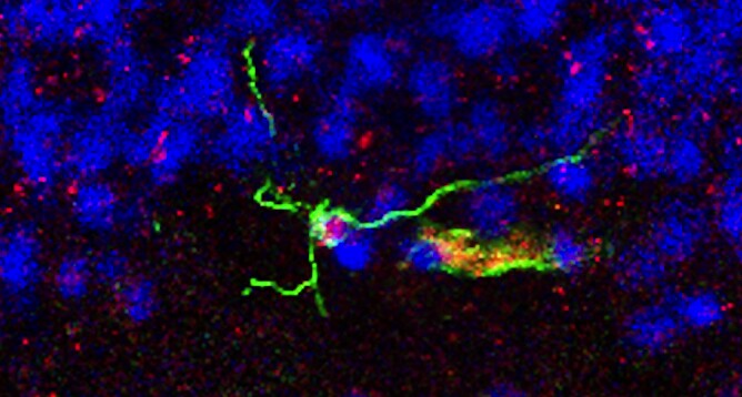 A neural stem cell in the brain