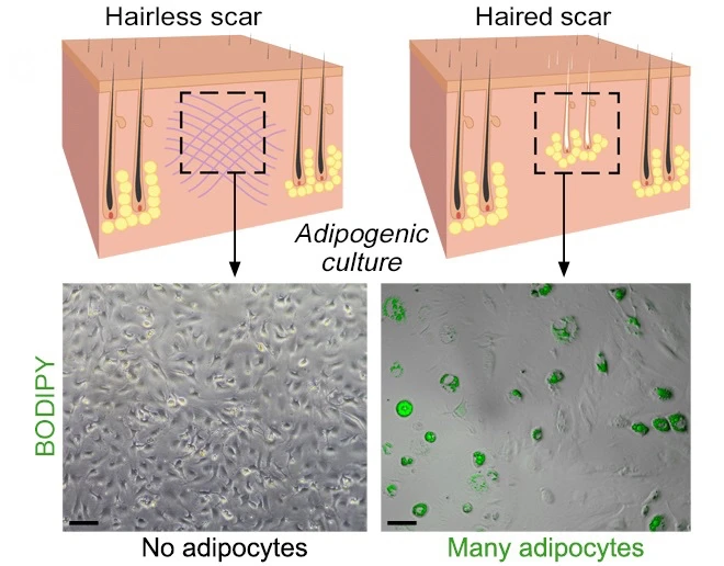 The secret is to regenerate hair follicles first, says Cotsarelis