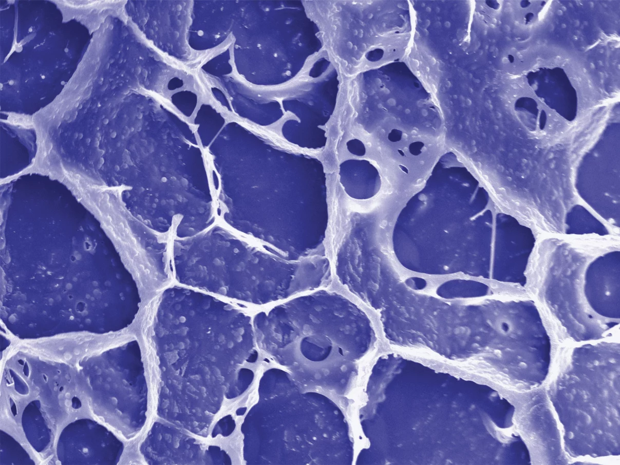 The gel helps the immune system target and kill any cancer cells that remain after tumor-removal surgery