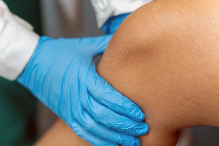 A knee that's noisy straight after an injury doesn't always result in osteoarthritis