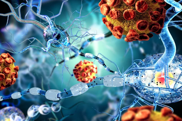 Reducing brain inflammation associated with multiple sclerosis is a key aim for researchers