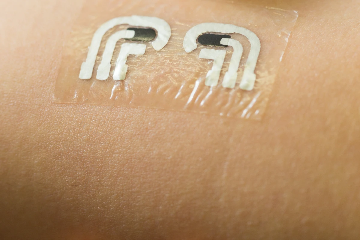 The tattoo measures glucose levels in fluid between the skin cells, which reflects levels in the bloodstream