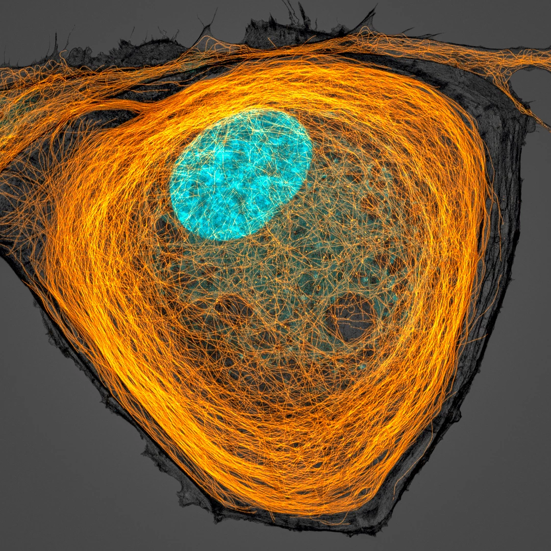 7th Place. Microtubules (orange) inside a cell. Nucleus is shown in cyan