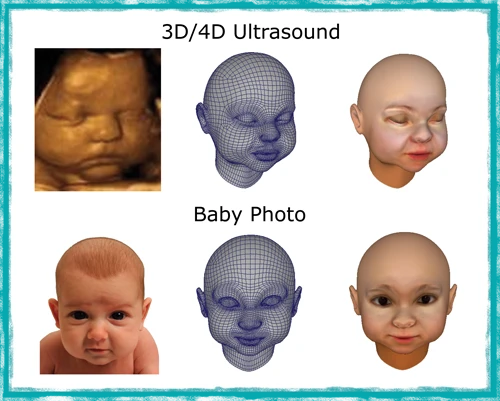 3D Babies also offers models based on photos of your baby once it is born