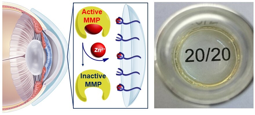 A diagram of the MMP-neutralizing contact lens