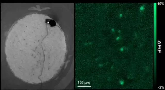 One of the test mice, and a live video feed of its fluorescing neurons