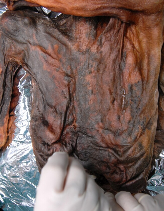it took almost 20 years for Ötzi's stomach contents to be analyzed because for a long time, no one could find his stomach after it moved during the mummification process