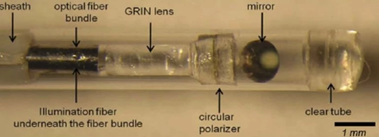 A close-up view of the catheter
