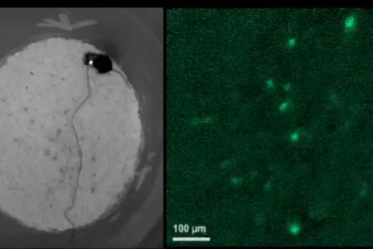 One of the test mice, and a live video feed of its fluorescing neurons