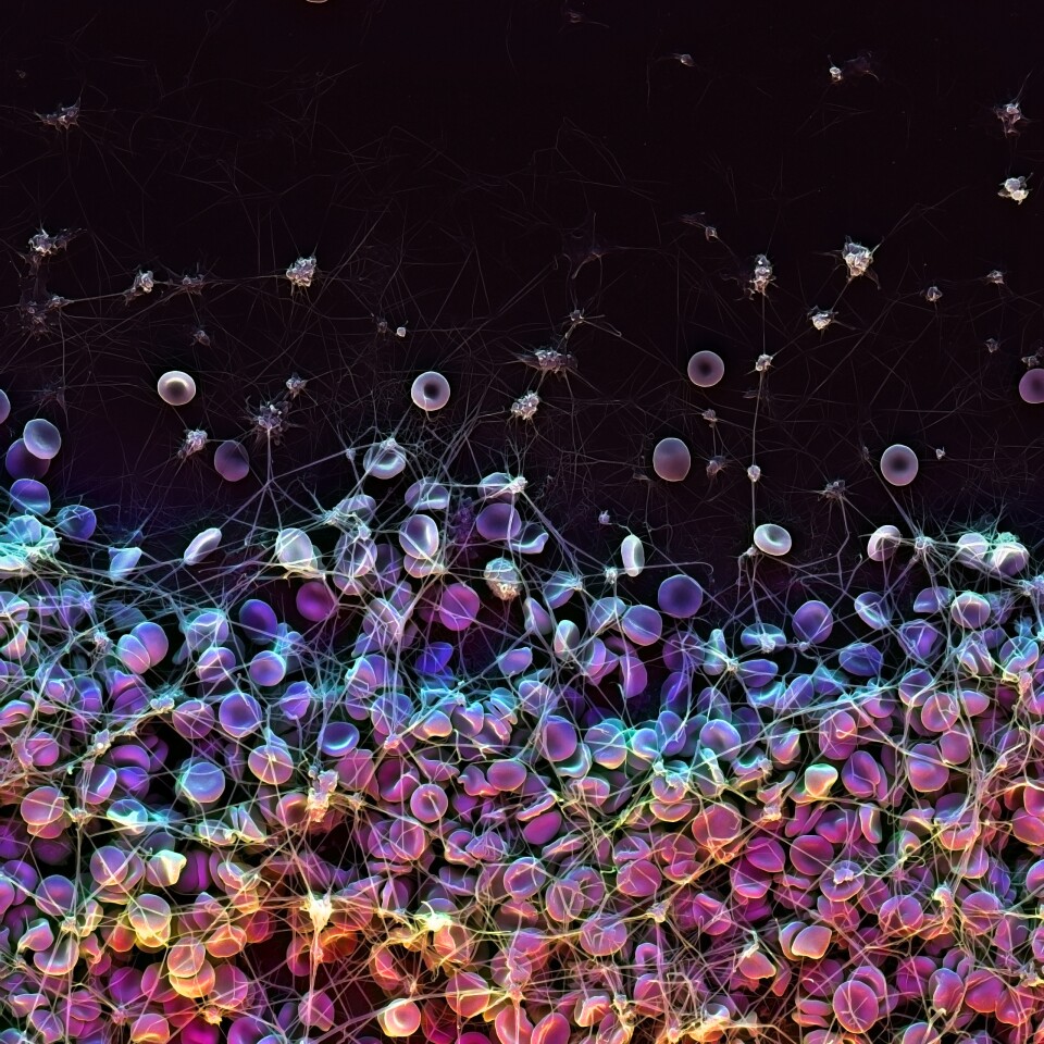 Scanning Electron Microscope (SEM) image showing how red blood cells coagulate to form a blood clot (Image: James Weaver, Harvard’s Wyss Institute)