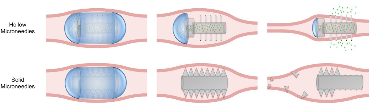The team is working on two designs for the capsule, one with fixed hollow needles and another with solid needles designed to break away and embed themselves in the intestinal wall (Image: MIT)