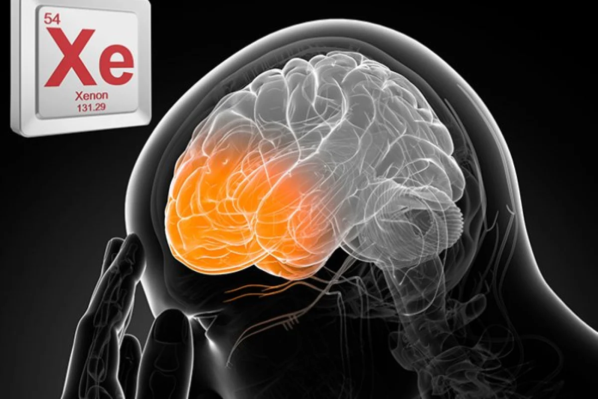 The anesthetic gas, if administered within three hours of a head injury, could help prevent long-term brain damage