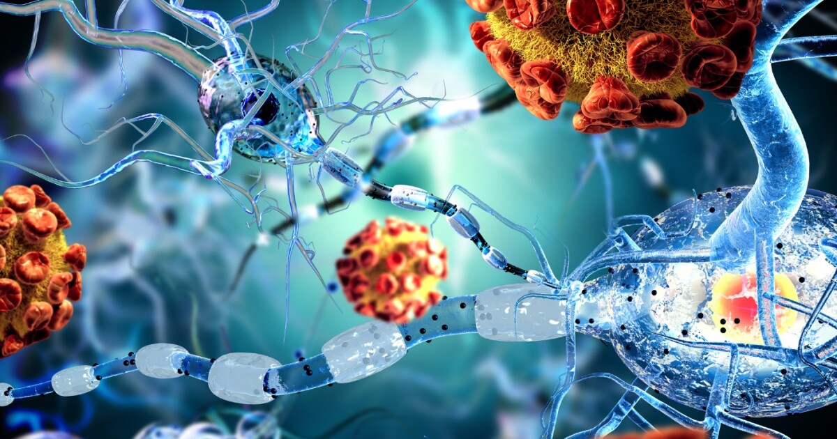 Immune cells from the gut found to reduce MS-related brain ...