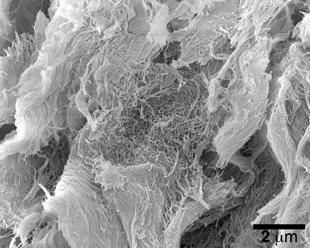 A scanning electron microscope image of the injectable cancer-fighting hydrogel, dubbed STINGel
