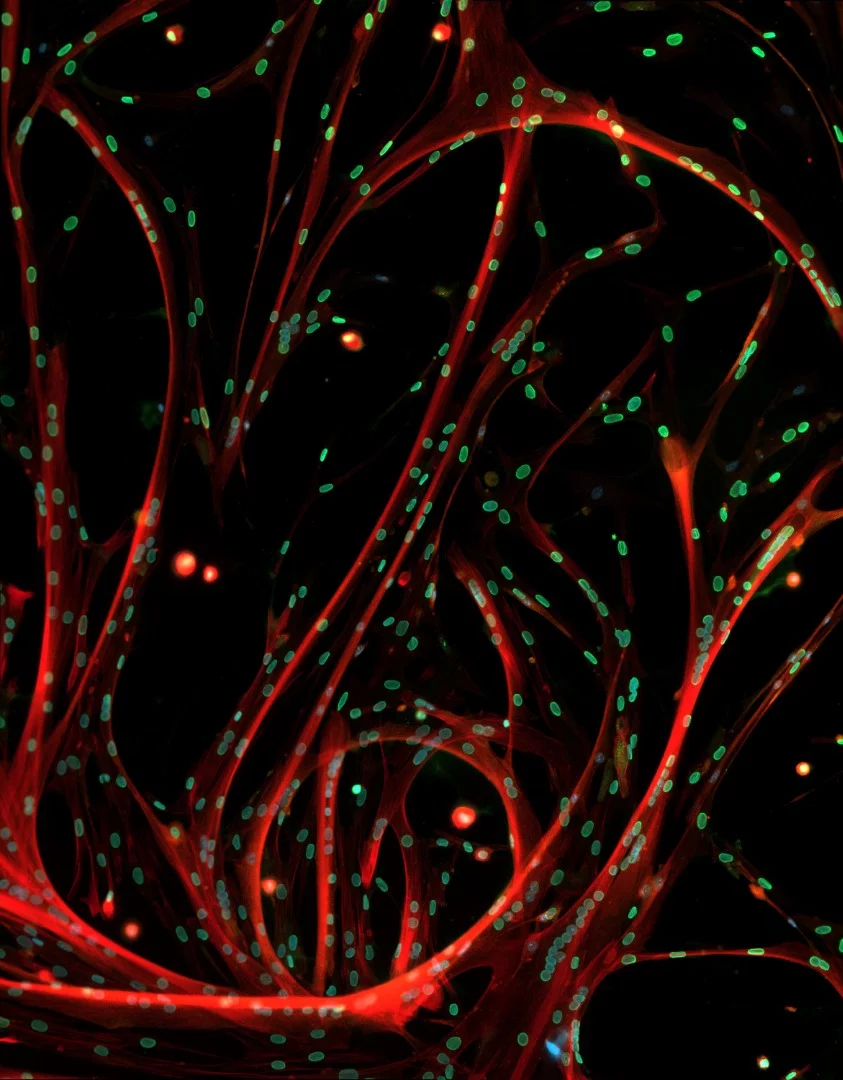 Image of Distinction: Skeletal muscle cells