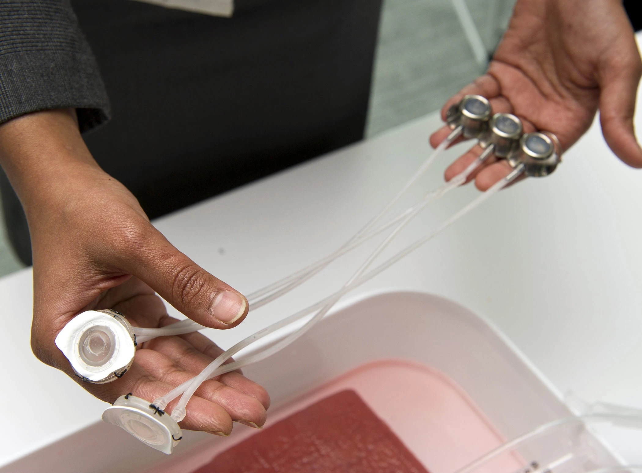 Students from Johns Hopkins University have created an implantable device, that could make dialysis treatments safer and easier (Photo: Johns Hopkins University)