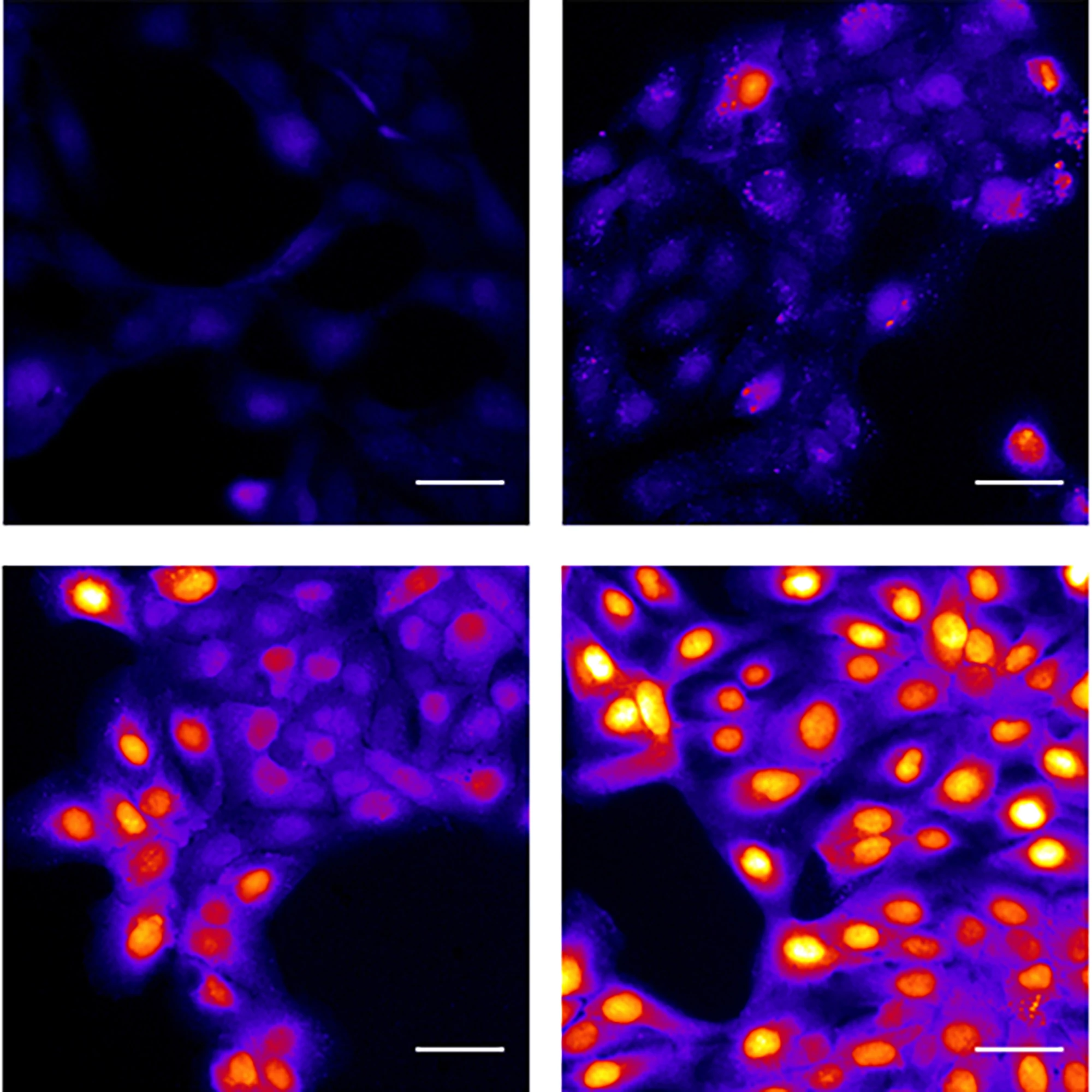 Calcium responses to different concentrations of lidocaine in head and neck cancer cells