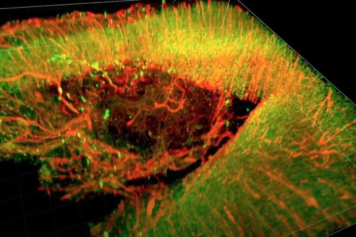 A 3D image of a recovering injured rat brain treated with a newly developed "brain glue"