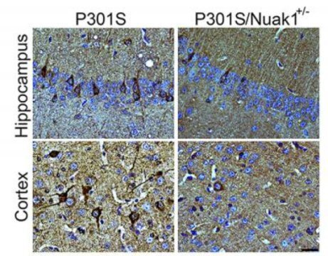 Build-up of the protein known as tau forms tangles in brain tissue seen as the dark spots on the left, but cutting the enzyme that produces it – Nuak1 – by 50 percent leads to far fewer tangles (right side)