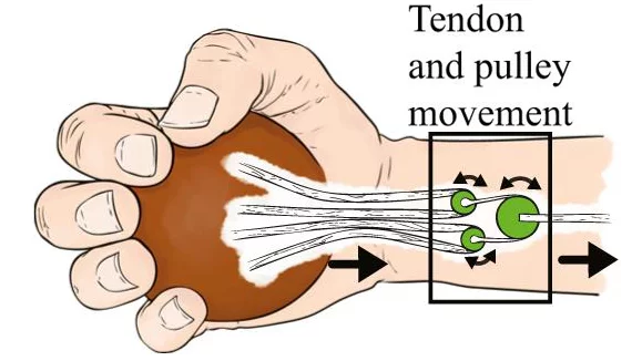A pulley mechanism developed at OSU may some day be implanted into the hands of people with nerve damage and help them regain a more natural grasping ability with their fingers (Image: OSU)