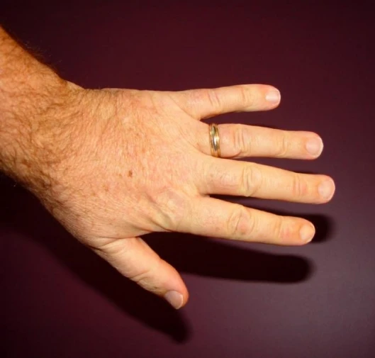 Our editor's hand - according to this study, he was probably pretty bad at maths!