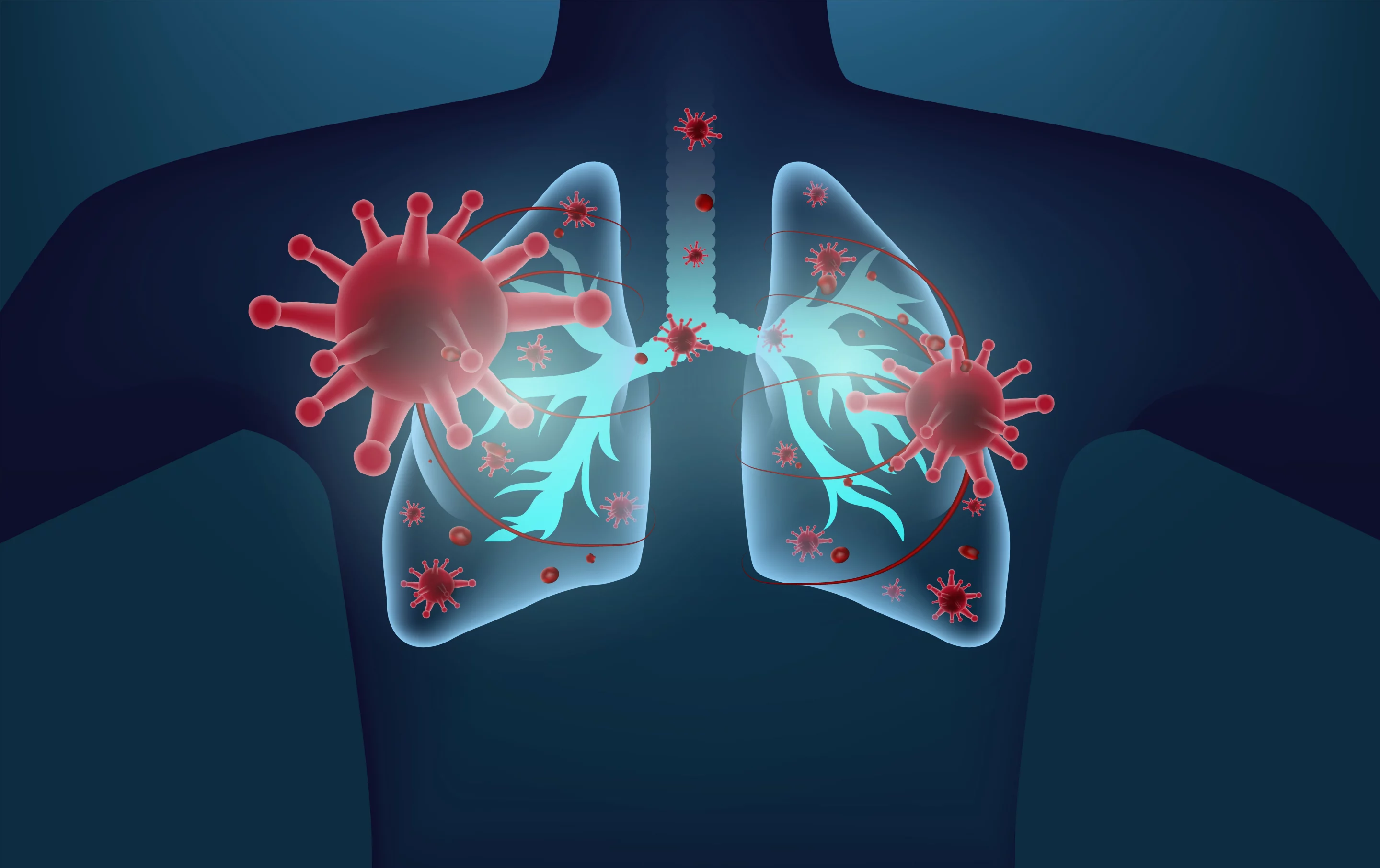 Research indicates newer COVID variants stemming from BA.2.86 can infect the lungs more effectively than any variant since Delta