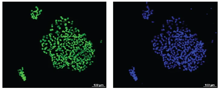 Marker staining of hiPSCs (Photo: Loh Yuin Han, Jonathan, IMCB)