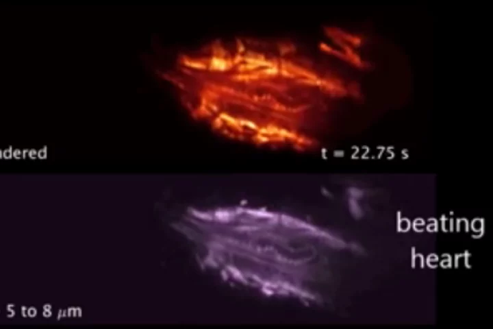 A new 3D microscope has been developed at Columbia University Medical Center that is able to capture detailed images of living things at very high speeds (Photo: CUMC)